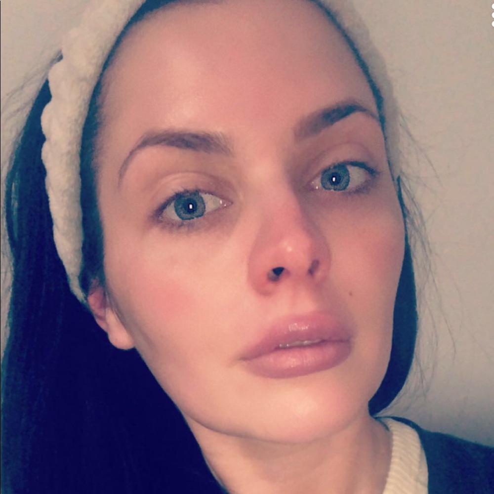 🌞&🌛 Simple Daily Skincare Routine READ BELOW! - Picture 4 of 6